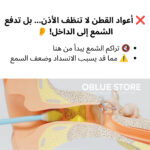 ⁦جهاز تنظيف الأذن الذكي بكاميرا HD – رؤية واضحة وتنظيف آمن و متكامل للأذن بدون أي مخاطرة⁩ - الصورة ⁦2⁩
